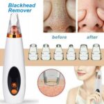 Multi Functional Cleaning Remove Blackhead Device - Image 2